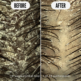 Tónico para el cuero cabelludo Care Taker - 75ml